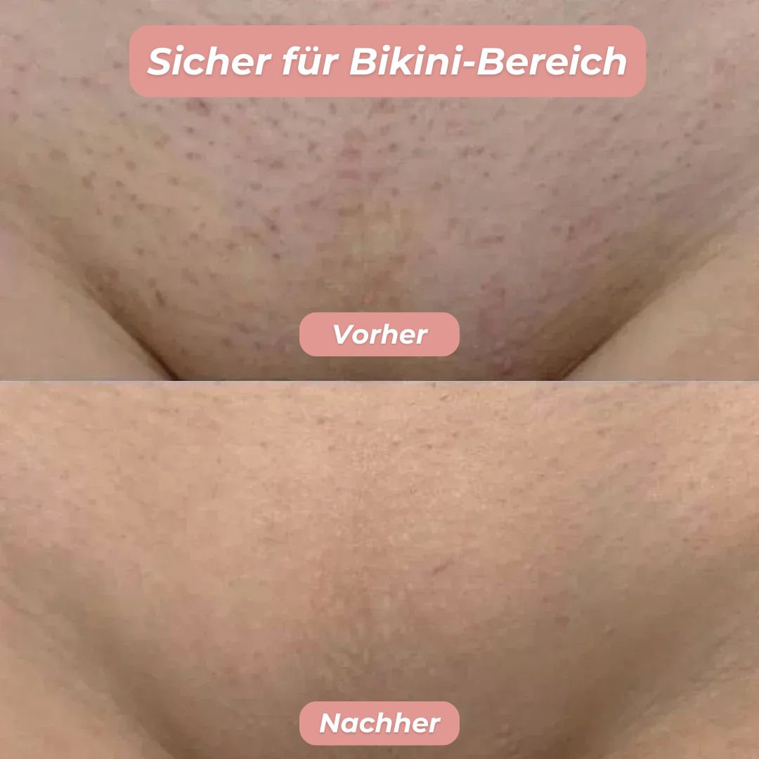 glatty™ | 2-in-1 Rasierer