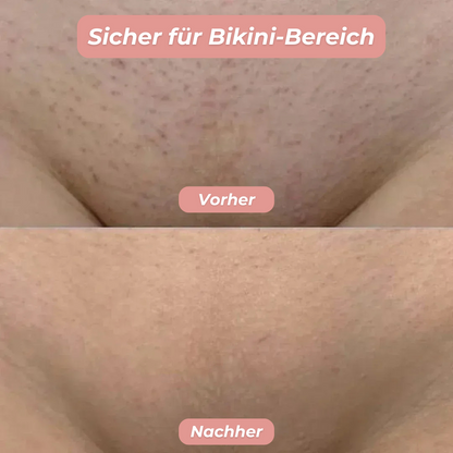 glatty™ | 2-in-1 Rasierer