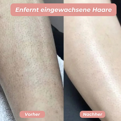 glatty™ | 2-in-1 Rasierer