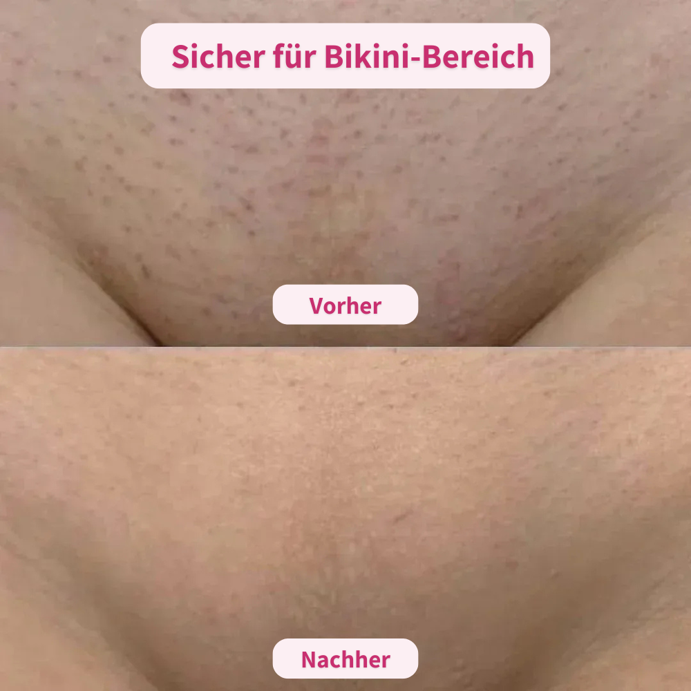 Glatty™ | 2 in 1 Rasierer